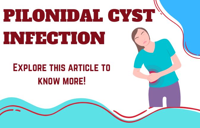 pilonidal cyst infection