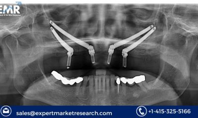 Zygomatic and Pterygoid Implants Market